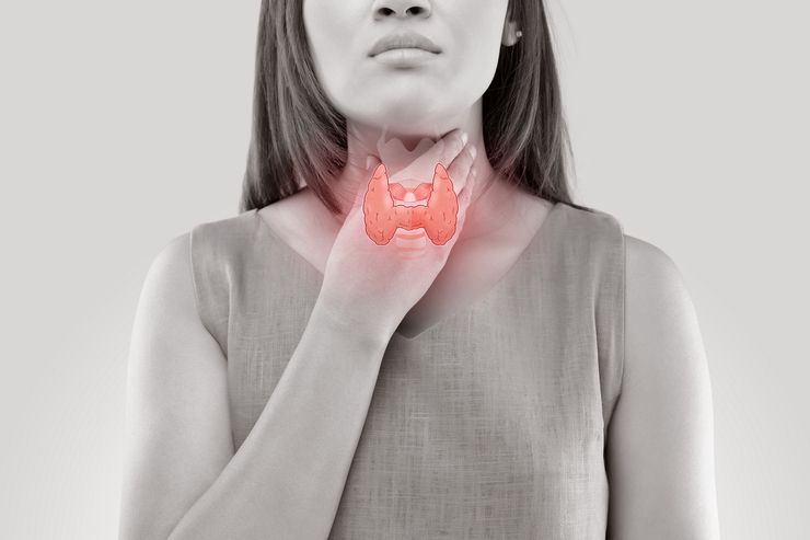 зоб щитовидной железы симптомы у женщин