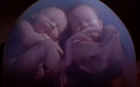 беременность близнецами фото