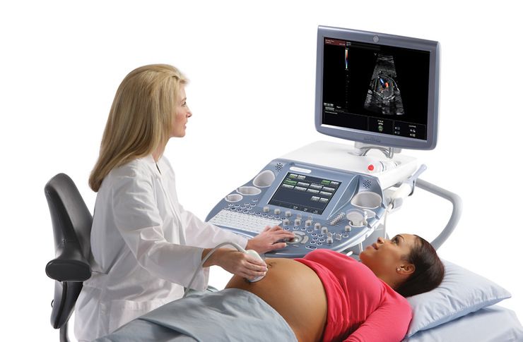 допплерография при беременности