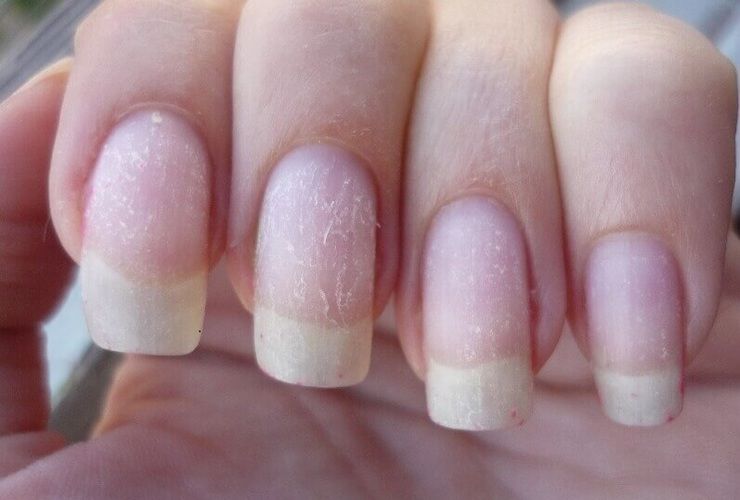 как восстановить ногти после шеллака