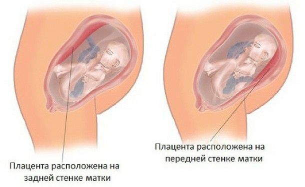 Крепление хориона по задней стенке