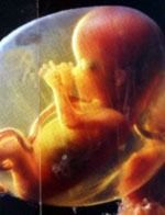 беременность 13 недель, беременность 14 недель, беременность 15 недель, беременность 16 недель