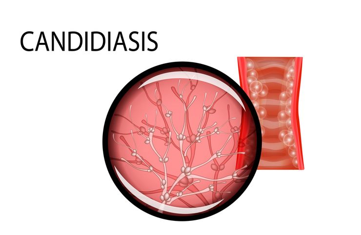 Что такое Candida albicans 