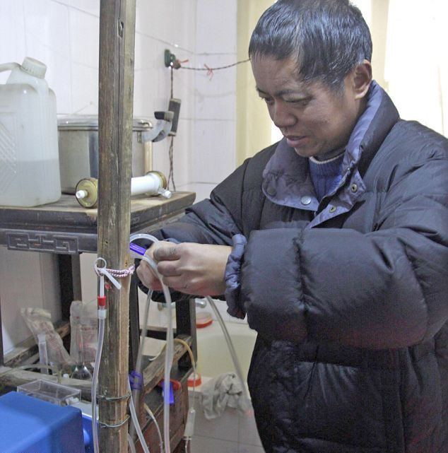 Китаец 13 лет очищает себе кровь с помощью самодельного аппарата для гемодиализа