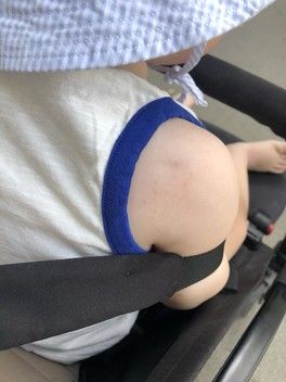 А это норма что потница все сильнее? А это норма что потница все сильнее?