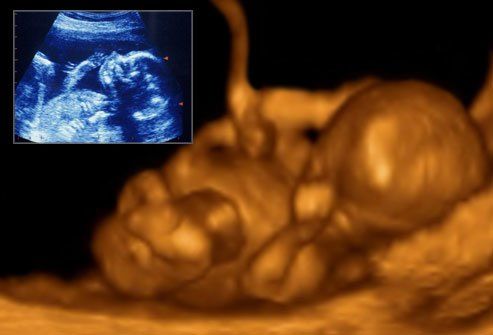 Развитие плода по месяцам : Развитие эмбриона на 24 неделе.  
 
Вес ребенка уже 650 г. Ребенок реагирует на звуки учащенным сердцебиением или движениями. Когда он икает, можно ощутить некоторые его движения. В этот период уже полностью сформировалось внутреннее ухо и благодаря этому он уже понимает, находится ли он головой вниз или вверх.