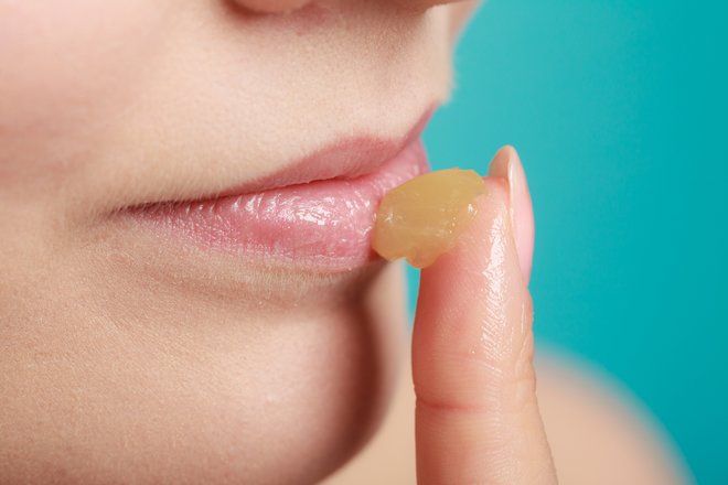 Дерматолог дал 5 советов по восстановлению обветренных губ