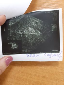 Потолгия ?:( Потолгия ?:(