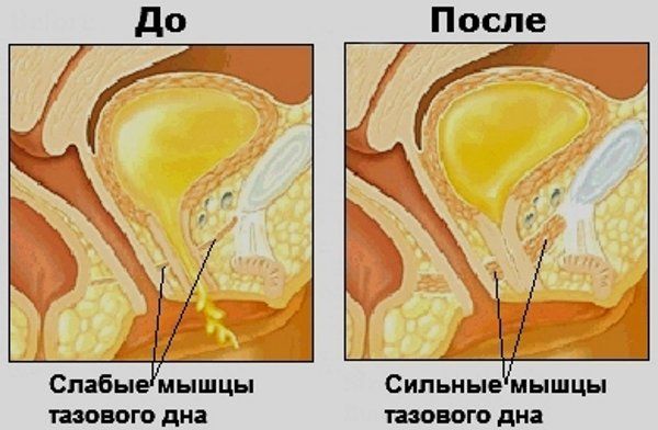 Вопрос к тем, кто использовал (использует) вагинальные шарики