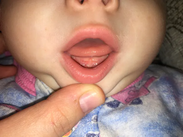 🦷 🦷