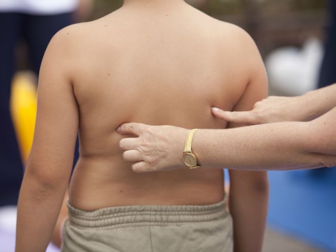 Лишний вес у ребенка: в чем причины и как лечить?