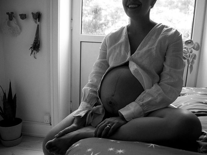 У 75% будущих мам: гинекологи рассказали о гиперпигментации при беременности